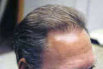 Male Hair example 4 after